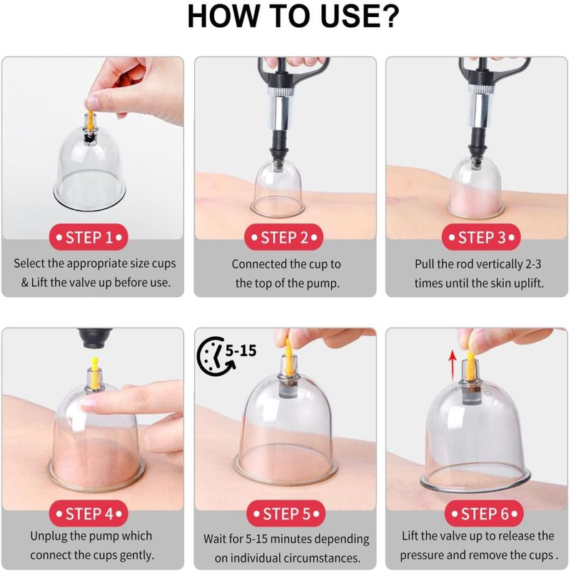 Massage Therapy Cupping Kit
