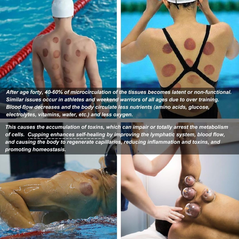Massage Therapy Cupping Kit