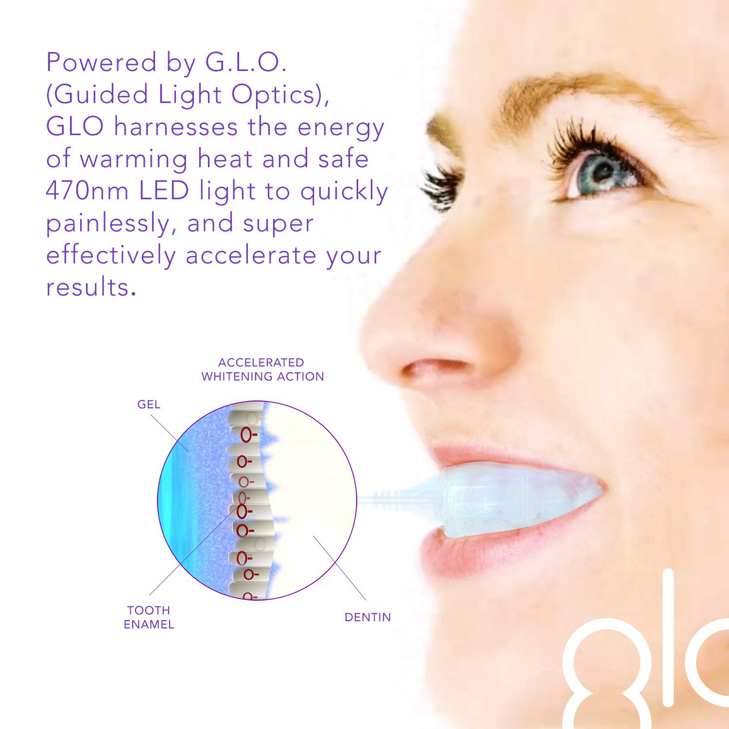 GLO Brilliant Deluxe Teeth Whitening Device Kit with Patented Blue LED Light & Heat Accelerator for Fast, Pain-Free, Long Lasting Results