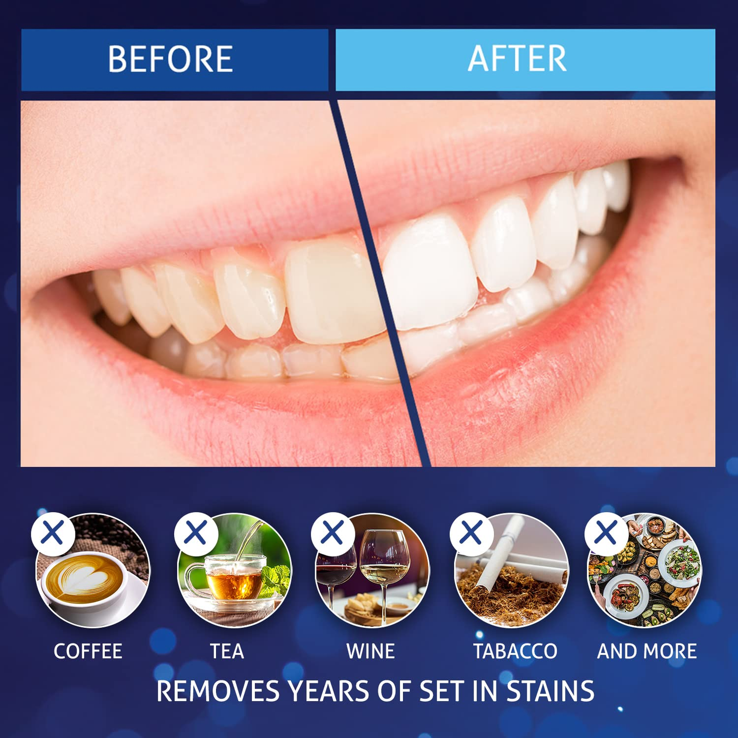 Magicbrite Complete Teeth Whitening Kit at Home Whitener - LED Light, 35% Carbamide Peroxide, 2 Mouth Trays, (3) 3Ml Gel Syringes, Painless Effective