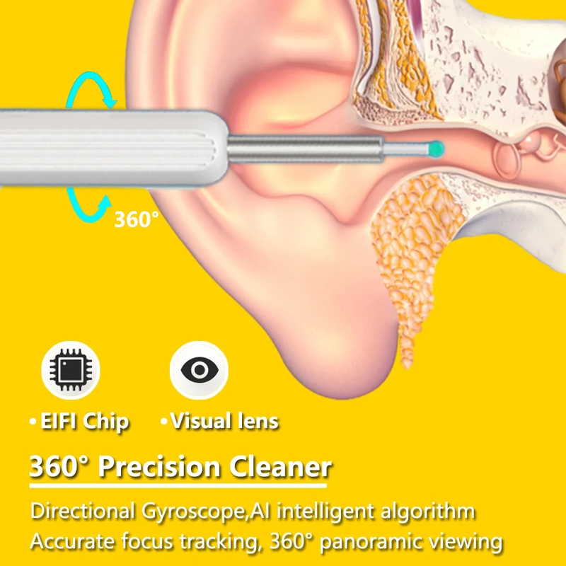 11 Pcs Wireless Earpick, Ear Wax Removal Kit with Camera 1296P HD with 6 LED Lights & Silicone Soft Ear Tips 