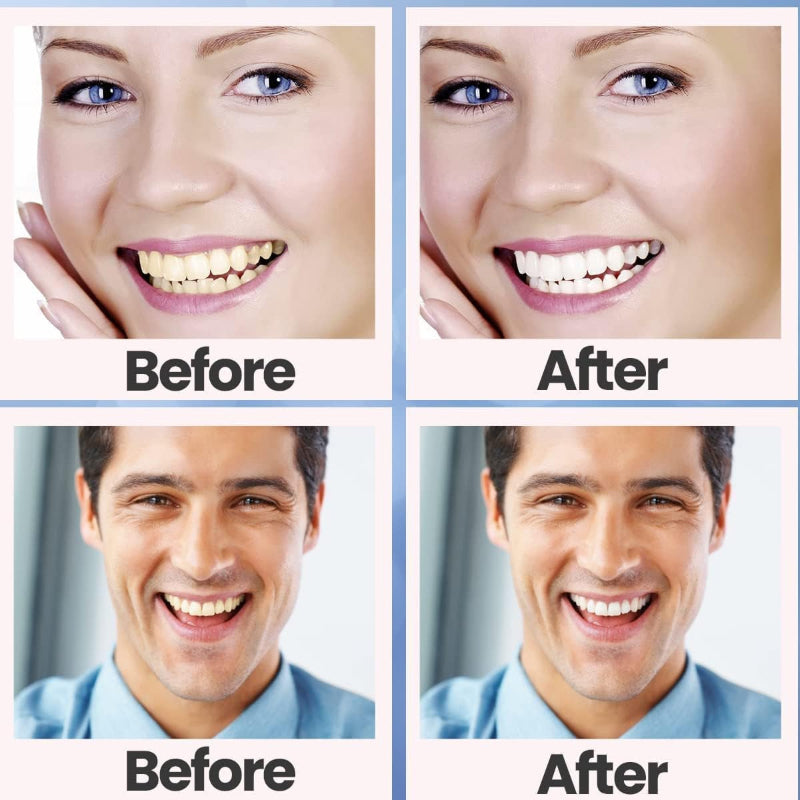 Teeth Whitening Strips, 28 Pcs for Sensitive Teeth, Removes Coffee/Soda/Wine Stains