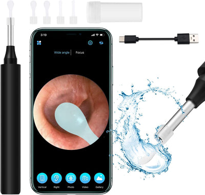 Ear Wax Removal Tool with Camera - Ear Cleaner Kit with 4 Ear Spoon - HD Wifi Visual Ear Wax Remover Kit Compatible Ios/Android - Improves Hearing or Ear Health Naturally for Kids, Adults