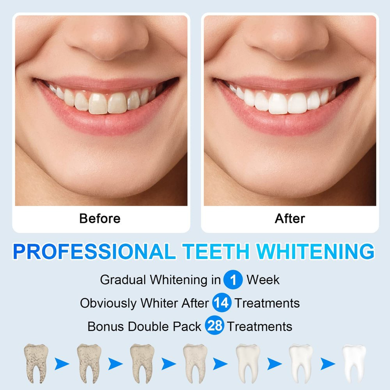 Teeth Whitening Strips, 28 Pcs (14 Treatments) Whitestrips
