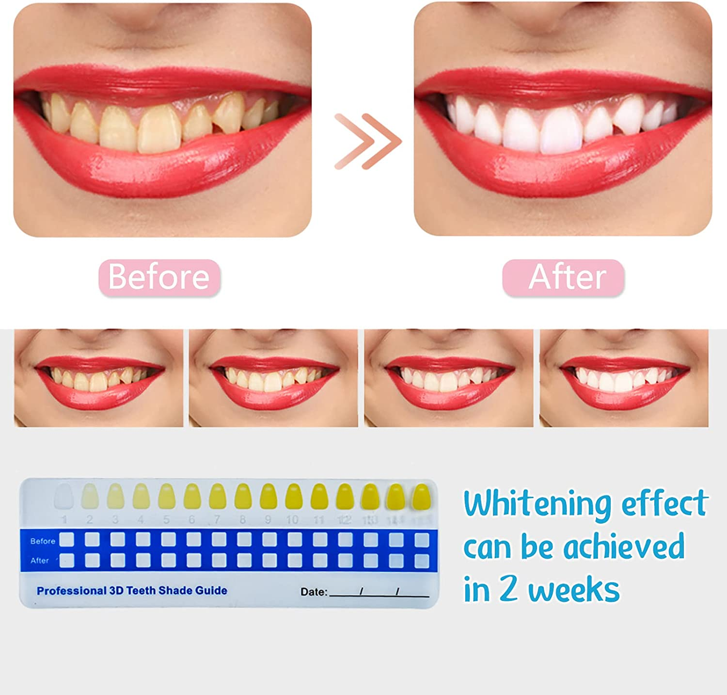 Teeth Whitening Kit with Blue Led Light, Professional Tooth Whitener with 4 Pcs Non-Sensitive Whitening Gel Pens, 2 Weeks Can Effectively Reduce Yellow Teeth Stains Caused by Coffee/Wine/Smoking.