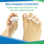 Vive Hammer Toe Straightener 3 Loop (4 PK) Corrector Cushion for Women, Men - Bunion Foot Relief - Feet Alignment for Curled Claw Crooked and Mallet Toes - Right and Left Gel Guard - Overlap Spreader