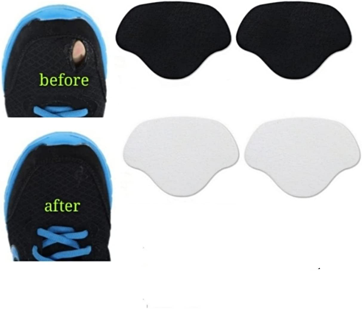 Heng Happy Sneaker Toebox/Heel Blowout Prevention Repair, Shoe Hole Toeburst Patch/Insert, Wear Self-Adhesive, 1Pairs of Black and 1 Pair of White