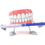 Professional Teeth Whitening Kit 